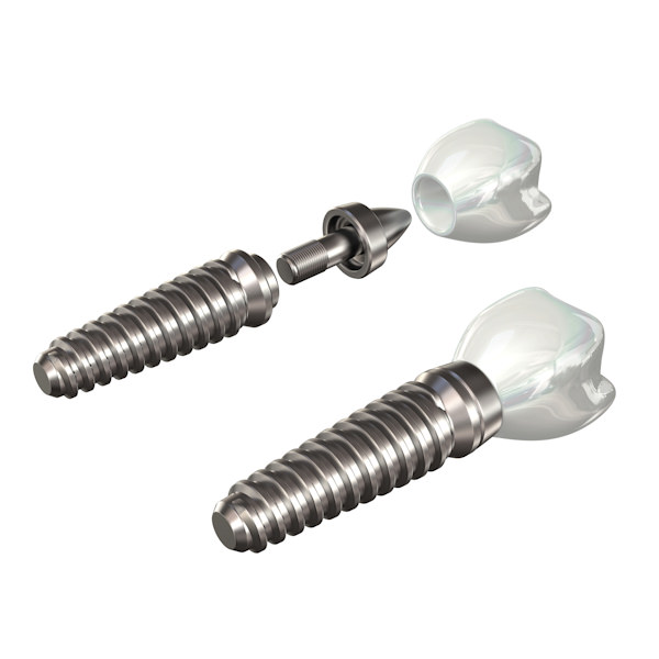 Dental implant