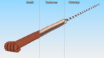 Large Acupuncture Needle Gold
