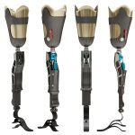 Prosthetic Leg