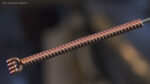 Short Acupuncture Needle Gold