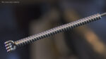 Short Acupuncture Needle Silver