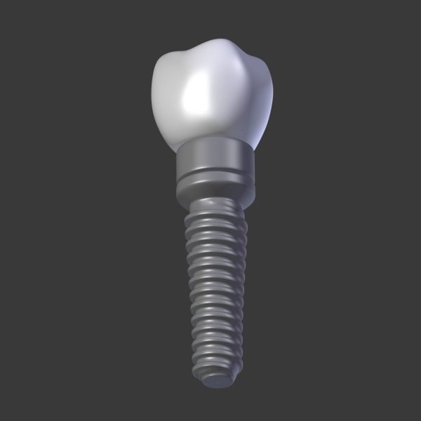 Tooth Implant - premolar