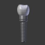 Tooth Implant - premolar