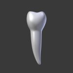 Tooth Implant - premolar