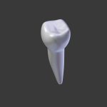 Tooth Implant - premolar