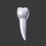 Tooth Implant - premolar