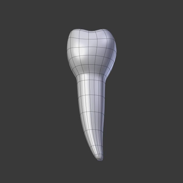 Tooth Implant - premolar