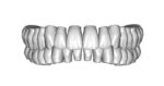 Upper and lower jaw teeth anatomy