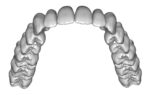 Upper jaw teeth anatomy