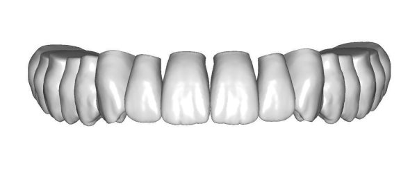 Upper jaw teeth anatomy