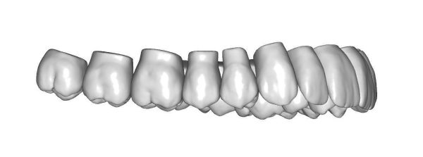 Upper jaw teeth anatomy