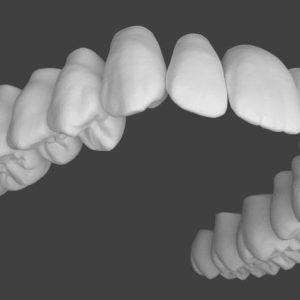 Upper jaw teeth anatomy