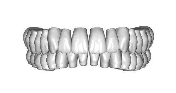 Upper jaw teeth anatomy